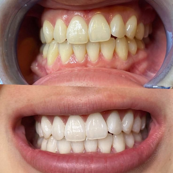 OralWave Enjuague bucal violeta